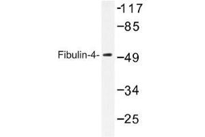 Image no. 1 for anti-Fibulin 4 (FBLN4) antibody (ABIN317833) (FBLN4 antibody)