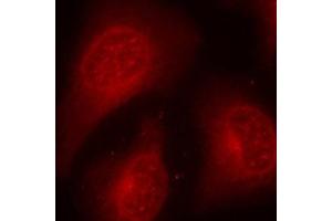 Immunofluorescence (IF) image for anti-Histone Deacetylase 8 (HDAC8) (pSer39) antibody (ABIN1870227) (HDAC8 antibody  (pSer39))