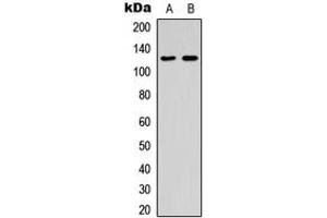 Western blot analysis of ST5 expression in K562 (A), human spleen (B) whole cell lysates. (ST5 antibody  (Center))
