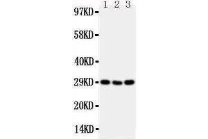 Anti-CD134/OX40 antibody,  Western blotting Lane 1: Mouse Brain Tissue Lysate Lane 2: Mouse Spleen Tissue Lysate Lane 3: Mouse Liver Tissue Lysate (TNFRSF4 antibody  (N-Term))