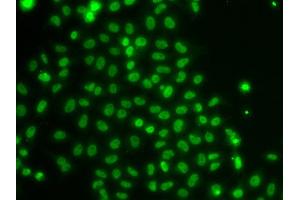 Immunofluorescence analysis of U20S cell using TOX antibody. (TOX antibody)