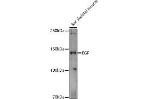 Western blot analysis of extracts of Rat skeletal muscle, using EGF antibody (ABIN6133981, ABIN6139971, ABIN6139973 and ABIN6217680) at 1:1000 dilution. (EGF antibody  (AA 850-950))