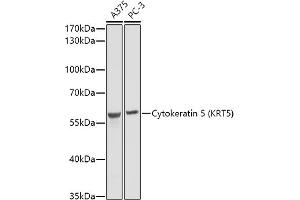 Western Blotting (WB) image for anti-Keratin 5 (KRT5) antibody (ABIN3016405)