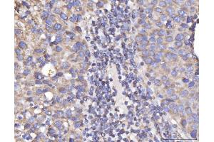 IHC analysis of DLST using anti-DLST antibody (ABIN7599412). (DLST antibody  (AA 1-453))
