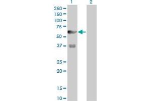 Western Blot analysis of PFKFB3 expression in transfected 293T cell line by PFKFB3 monoclonal antibody (M08), clone 3F3.