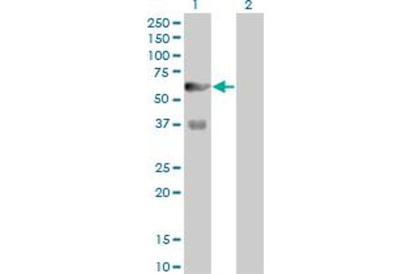 PFKFB3 Antikörper  (AA 412-520)
