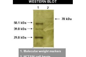 Western Blotting (WB) image for anti-RYK Receptor-Like Tyrosine Kinase (RYK) antibody (ABIN264516)