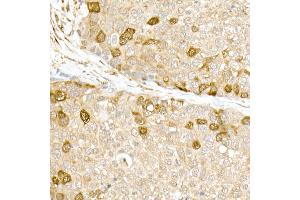 Immunohistochemistry of paraffin-embedded rat liver using CD81 Rabbit pAb (ABIN6134776, ABIN6138231, ABIN6138232 and ABIN6220897) at dilution of 1:50 (40x lens). (CD81 antibody  (AA 1-100))