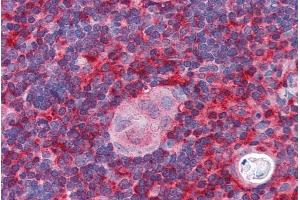 ABIN184750 (5µg/ml) staining of paraffin embedded Human Thymus. (ARPC1B antibody  (N-Term))