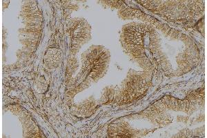 ABIN6278110 at 1/100 staining Mouse colon tissue by IHC-P. (DAP Kinase 1 antibody  (Internal Region))