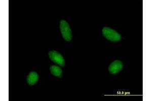 Immunofluorescence of purified MaxPab antibody to CDA on HeLa cell. (CDA antibody  (AA 1-146))