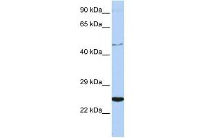 WB Suggested Anti-CRLF1 Antibody Titration:  0. (CRLF1 antibody  (Middle Region))