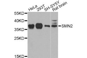 Western blot analysis of extracts of various cell lines, using SMN2 Antibody (ABIN5974442) at 1/1000 dilution. (SMN2 antibody)