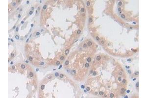 Detection of DDAH1 in Human Kidney Tissue using Polyclonal Antibody to Dimethylarginine Dimethylaminohydrolase 1 (DDAH1) (DDAH1 antibody  (AA 20-215))