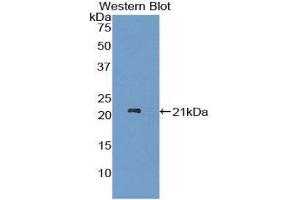 Western Blotting (WB) image for anti-ADAM Metallopeptidase with thrombospondin Type 1 Motif, 12 (ADAMTS12) (AA 823-997) antibody (ABIN1857900) (ADAMTS12 antibody  (AA 823-997))