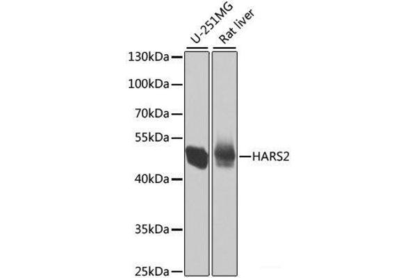 HARS2 antibody