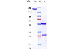 Anti-TNFRSF8 / CD30 Reference Antibody (brentuximab) on SDS-PAGE under reducing (R) condition. (Recombinant TNFRSF8 (Brentuximab Biosimilar) antibody)