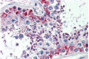 Human Testis (formalin-fixed, paraffin-embedded) stained with MAS1 antibody ABIN462250 followed by biotinylated goat anti-rabbit IgG secondary antibody ABIN481713, alkaline phosphatase-streptavidin and chromogen. (MAS1 antibody  (AA 187-236))