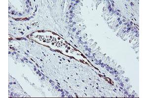 Image no. 2 for anti-Dystrobrevin, beta (DTNB) antibody (ABIN1497914) (Dystrobrevin beta antibody)