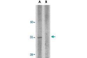 Western blot analysis of RWDD3 in rat kidney tissue lysate with RWDD3 polyclonal antibody  at 1 ug/mL in (A) the absence and (B) the presence of blocking peptide. (RWDD3 antibody  (C-Term))