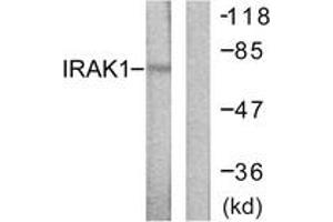 Western Blotting (WB) image for anti-Interleukin-1 Receptor-Associated Kinase 1 (IRAK1) (AA 353-402) antibody (ABIN2888667) (IRAK1 antibody  (AA 353-402))