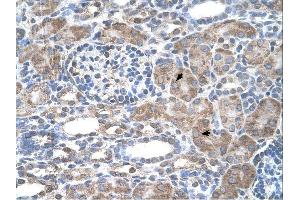 IFI44L antibody was used for immunohistochemistry at a concentration of 4-8 ug/ml.