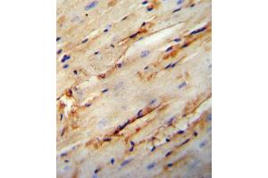 COL5A1 antibody immunohistochemistry analysis in formalin fixed and paraffin embedded mouse heart tissue followed by peroxidase conjugation of the secondary antibody and DAB staining. (COL5A1 antibody  (N-Term))