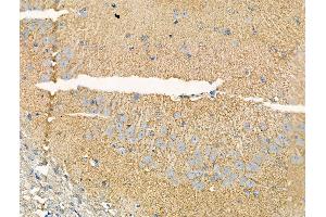 ABIN6265703 and ABIN6268929 at 1/100 staining Rat brain tissue by IHC-P.