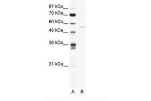 Image no. 1 for anti-ADP-Ribosylation Factor GTPase Activating Protein 2 (arfgap2) (AA 114-163) antibody (ABIN202710) (arfgap2 antibody  (AA 114-163))