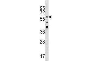 Western blot analysis of CAMK2G antibody in Jurkat lysate (CAMKII gamma antibody  (AA 309-338))