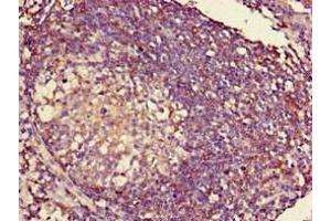 Immunohistochemistry of paraffin-embedded human lymph node tissue using ABIN7155626 at dilution of 1:100 (HLA-C antibody  (AA 25-308) (Biotin))