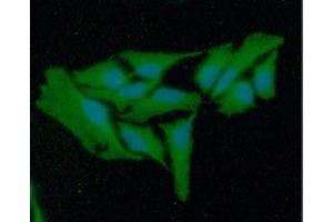 ICC/IF analysis of GSR in HeLa cells line, stained with DAPI (Blue) for nucleus staining and monoclonal anti-human GSR antibody (1:100) with goat anti-mouse IgG-Alexa fluor 488 conjugate (Green). (Glutathione Reductase antibody  (AA 43-522))