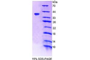 SDS-PAGE (SDS) image for Tensin 1 (TNS1) (AA 4-307) protein (His tag) (ABIN4989549) (Tensin 1 Protein (TNS1) (AA 4-307) (His tag))