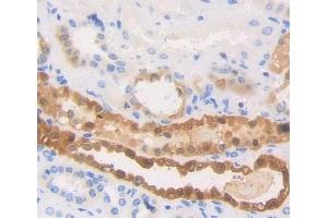 #VALUE! (HSPA6 antibody  (AA 1-387))