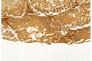ABIN6265271 and ABIN6272907 at 1/100 staining Rat testis tissue by IHC-P.