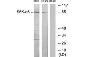 Western Blotting (WB) image for anti-Ribosomal Protein S6 Kinase, 90kDa, Polypeptide 6 (RPS6KA6) (AA 661-710) antibody (ABIN1534185)