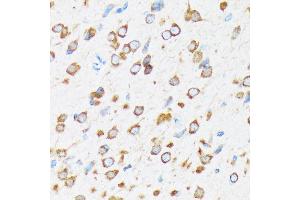 Immunohistochemistry of paraffin-embedded rat brain using K/Elp3 Rabbit mAb (ABIN1680361, ABIN3015008, ABIN3015009 and ABIN7101302) at dilution of 1:100 (40x lens). (ELP3/KAT9 antibody)