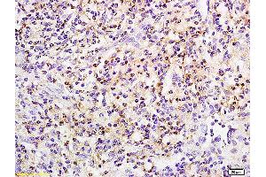 Formalin-fixed and paraffin embedded rat small intestine labeled with Anti phospho-PRKCB(Ser642) Polyclonal Antibody, Unconjugated (ABIN711461) at 1:200 followed by conjugation to the secondary antibody and DAB staining (Pkc beta 1 antibody  (pSer642))