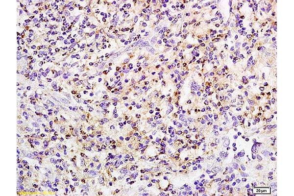 Pkc beta 1 antibody  (pSer642)