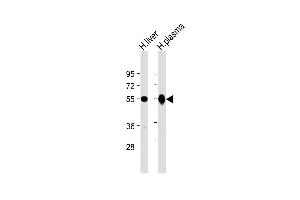 Western Blot at 1:2000 dilution Lane 1: human liver lysate Lane 2: human plasma lysate Lysates/proteins at 20 ug per lane. (Gc (AA 442-473) antibody)