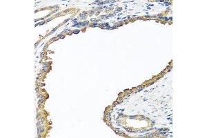 Immunohistochemistry of paraffin-embedded human prostate using NYX antibody. (Nyctalopin antibody  (AA 282-481))