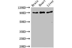 Western Blot Positive WB detected in: Mouse brain tissue, Rat heart tissue, Rat liver tissue All lanes: RPS6KA5 antibody at 3 μg/mL Secondary Goat polyclonal to rabbit IgG at 1/50000 dilution Predicted band size: 90, 62, 82 kDa Observed band size: 90 kDa