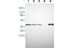 Western blot analysis of Lane 1: RT-4, Lane 2: U-251 MG, Lane 3: A-431, Lane 4: Liver, Lane 5: Tonsil with STX7 polyclonal antibody  at 1:250-1:500 dilution. (Syntaxin 7 antibody)
