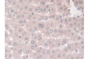 Detection of ADIPOR2 in Rat Liver Tissue using Polyclonal Antibody to Adiponectin Receptor 2 (ADIPOR2) (Adiponectin Receptor 2 antibody  (AA 1-147))