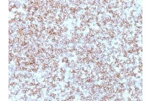 Formalin-fixed, paraffin-embedded human tonsil stained with HLA-DP / HLA-DR antibody (Bra-14). (HLA-DP/DR antibody)