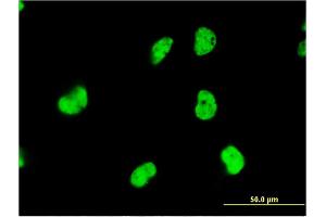 Immunofluorescence of monoclonal antibody to DAZAP1 on HeLa cell. (DAZAP1 antibody  (AA 308-407))