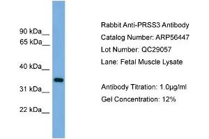 WB Suggested Anti-PRSS3  Antibody Titration: 0. (PRSS3 antibody  (N-Term))