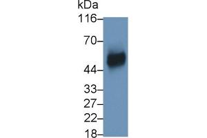 Detection of uPAR in RAW264. (PLAUR antibody  (AA 15-211))