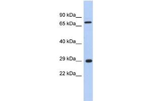 WB Suggested Anti-AKTIP Antibody Titration: 0.