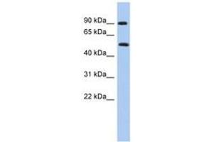 Image no. 1 for anti-Protein Arginine Methyltransferase 7 (PRMT7) (N-Term) antibody (ABIN6742956) (PRMT7 antibody  (N-Term))